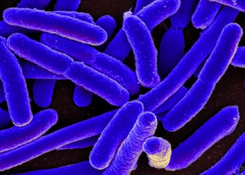 Escherichia coli fromage