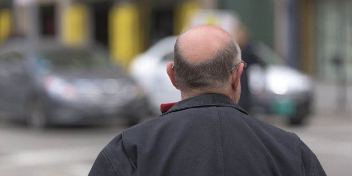 Médicament calvitie